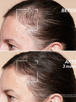 Anti-Hair Loss Serum