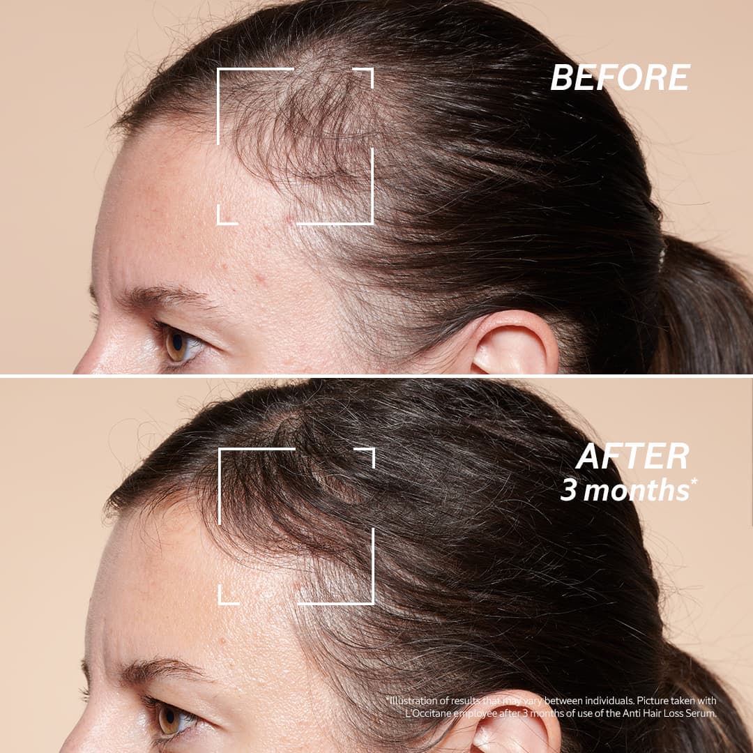 Anti-Hair Loss Serum